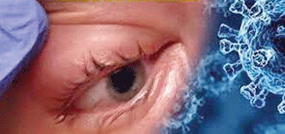 सचेत भए बच्न सकिन्छ कालो ढुसीबाट